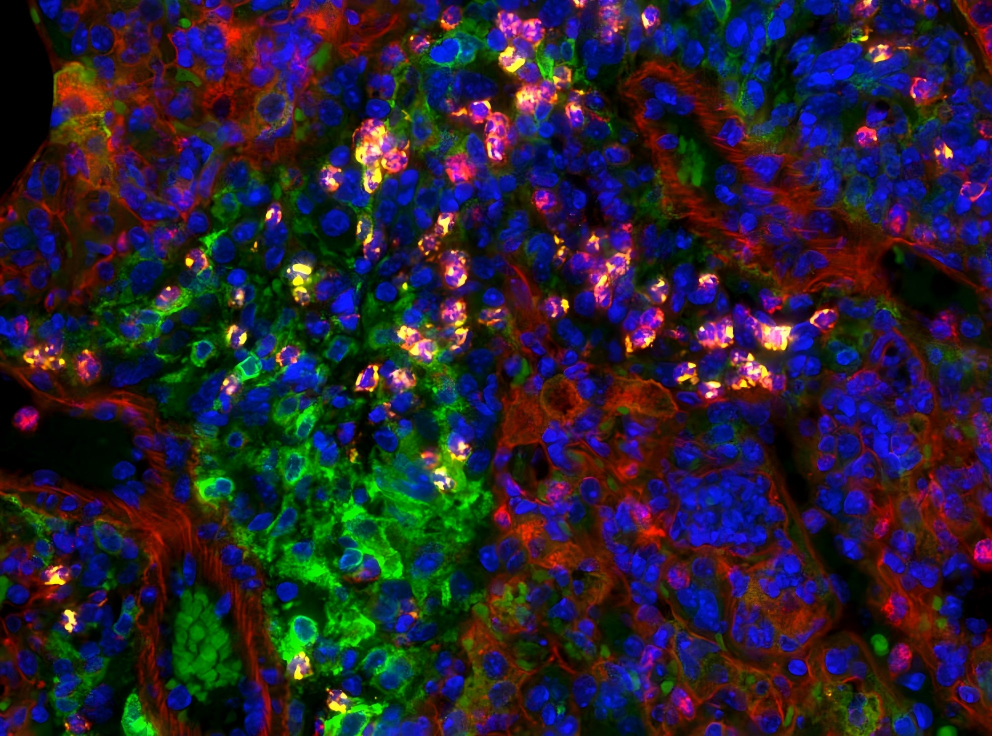 fluorescence microscope analysis1 - micro optics,optical filter,infrared components